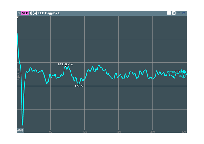 ISIS Software VEP ISIS Software VEP